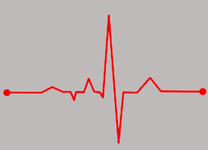 The EKG